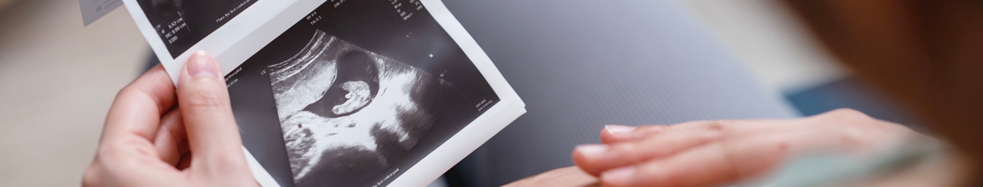 Gravid kvinna sitter ner och tittar på en ultraljudsbild av sin bebis